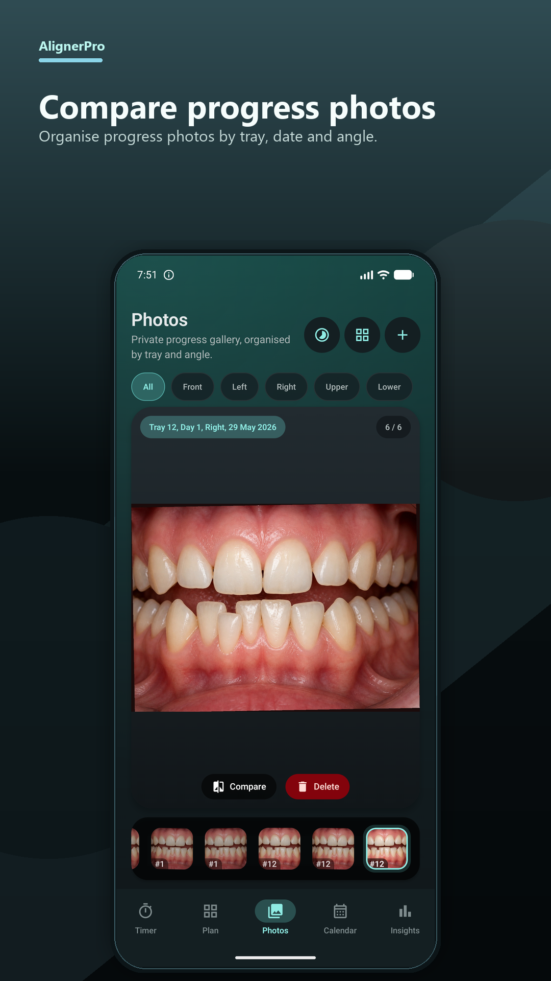 AlignerPro progress photo gallery showing a demo dental photo organised by tray, day and angle